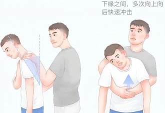 卡鱼刺别再喝醋、吞米饭 1招让它“跑出来”