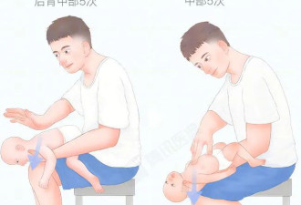 卡鱼刺别再喝醋、吞米饭 1招让它“跑出来”