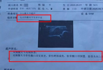 残疾夫妇二胎查出先天性病症，称医院产检漏检