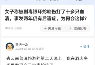 女子在酒店床上被毒蛇咬伤：扎16支血清，住院...