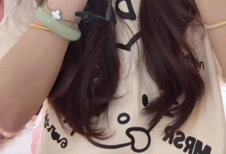 患克罗恩病的00后女孩术后自学插胃管 网友：很勇敢