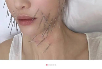 陈乔恩做“针雕”吓坏网友，全身插满上千支钢针，连脚趾也没放过