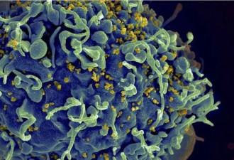 爱滋病有望治愈了!科学家透过mRNA技术找出HIV病毒