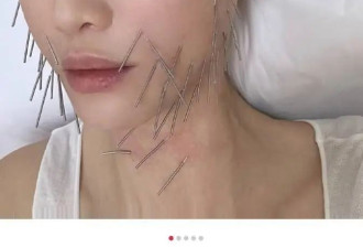 陈乔恩做“针雕”吓坏网友，全身插上千支钢针，连脚趾也没放过