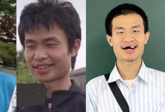 热帖：韦东奕，曝光的不只是健康问题...