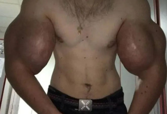 给双臂打6升凡士林....俄大力水手哥要废了