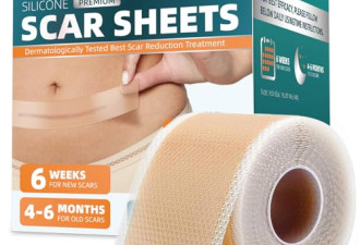 限时3.2 折，Silicone Scar Tape for Surgical Scars, 60"x1.6"