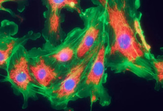 《科学》重磅 发现逆转开关 或根治4.6亿病患