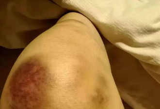 疑妻子出轨，贵州男子灌儿女农药致死....
