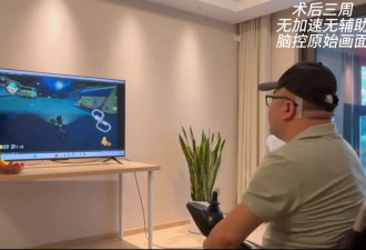 中国成功开展首例侵入式脑机接口临床试验