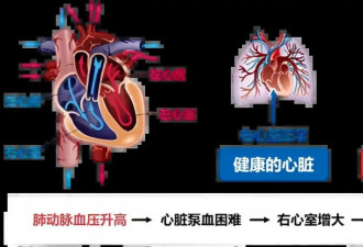前后被下了100多次病危通知书！知名主持人离世