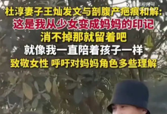 杜淳妻子王灿发文晒剖腹产疤痕 称这是一枚温柔而伟大的勋章