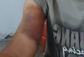 河南一男子称因发视频反映村干部家占道遭殴打