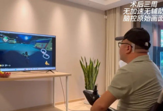 大脑被植入芯片后，他把马斯克当做英雄