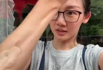 苗苗在家开荒种有机蔬菜，手臂磕伤满脸是汗，郑恺和岳父一起干活