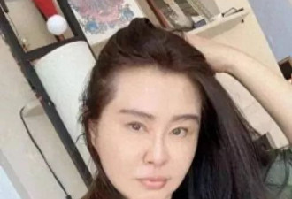 王祖贤穿着居士服现身机场，额头凹凸不平显老态