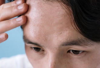 36°C高温！大多伦多迎来"危险酷热"：今晚持续至周二