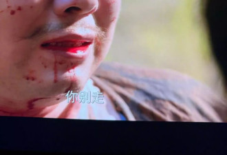 不顾于谦的告诫,岳云鹏跨界10年,其实面相早都变了