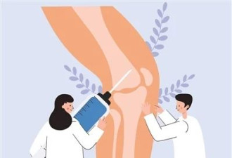 四个隐秘信号暗示膝盖健康危机