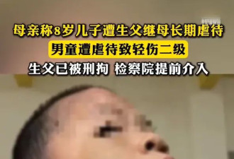 母亲称8岁儿子遭生父继母长期虐待，生父已被刑拘