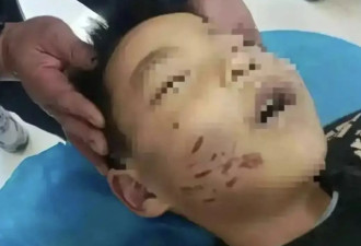 男童遭生母和男友残忍虐死 男友判死 生母判囚15年