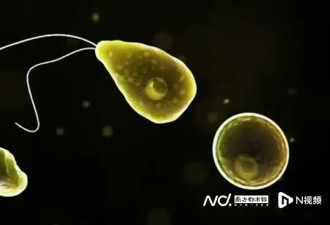 致死率97% 5岁女童感染“食脑虫”昏迷不醒