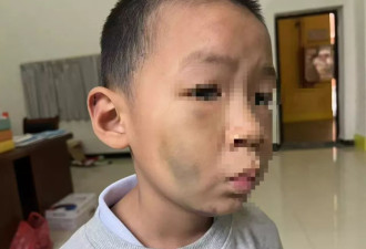 7岁男童被长期虐待？生父被刑拘