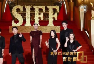 65岁知名女星惠英红自曝整容，“脸上缝过89针”