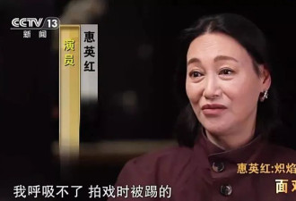 65岁知名女星惠英红自曝整容，“脸上缝过89针”