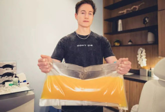 硅谷富豪的不死执念：AI接管身体 性生活都要预约
