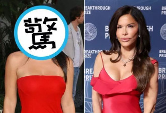 贝佐斯辣妻以前长这样!整形医分析"外貌进化"过程