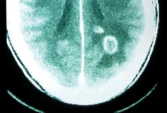 猫奴小心！它5分钟就能“斩首”人类精子
