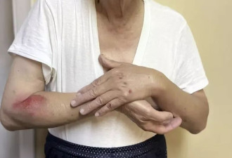 93岁知名侨领被女贼抢劫拖行！南加治安再亮红灯