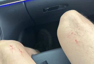 女星戴燕妮巴黎遭抢劫，车内惨状曝光，丢失银行卡，化妆师腿受伤