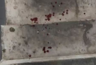 “他在家门口磨菜刀！”男子批邻居遛狗不拴绳被打伤