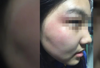 17岁女生与男同学冲突中被打致颅脑损伤,校方回应