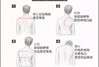 500万青少年中招，这病已成第三大健康威胁