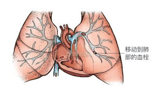 男人女人都爱的这个姿势 竟是健康杀手