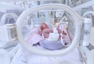 “你孩子没有肛门”，怕孩子被说闲话 甚至不敢送幼儿园