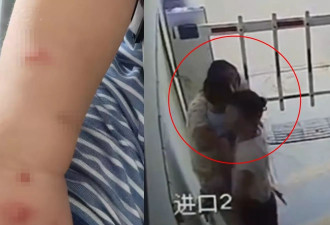 湖南1岁男童突遭陌生女强搂亲吻 男童当晚高烧……