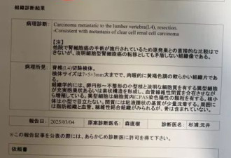女律师称在国内体检10年没预警，在国外确诊癌症晚期