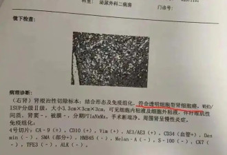 体检10年未预警却患癌症，每年体检是否还有意义?