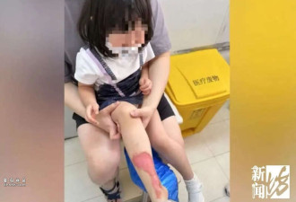 上海知名商场火锅店整壶滚烫高汤翻倒 崩溃