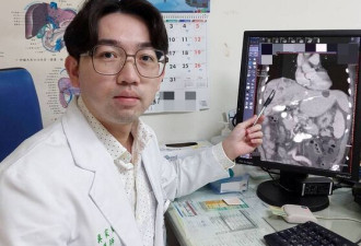 男半年狂掉4公斤 皮肤痒 竟是癌末