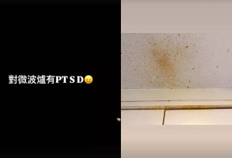 女演员微波炉煮鸡蛋被炸伤眼睛：眼角膜破了一个大洞
