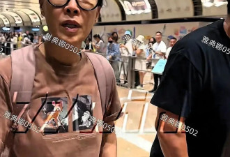 那英机场被偶遇：她的额头是填充还是植发？