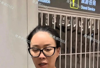 那英机场被偶遇：她的额头是填充还是植发？
