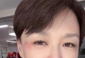 李小萌连续25年失眠，出现脑雾，全身插满电极做监测却查不出原因