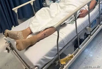 陈学冬近照曝光！35岁已一头白发，两年四次手术11部剧下架