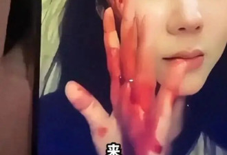 曝“赵四”刘小光儿子家暴，妻子晒伤痕令人揪心，施暴者应受惩罚